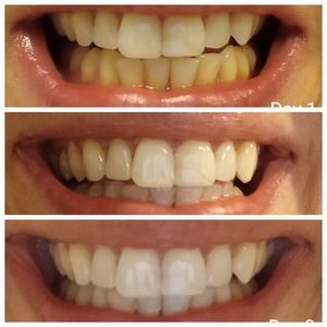 NIB Snow The Magic Powder Teeth Whitening Booster